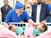 Mataan Soomaali Ah oo isku dhagnaa oo Si Guul Leh Loogu Kala Saaray Qalliinka Ka Dhacay King Abdullah Specialized Children’s Hospital Ee Riyadh